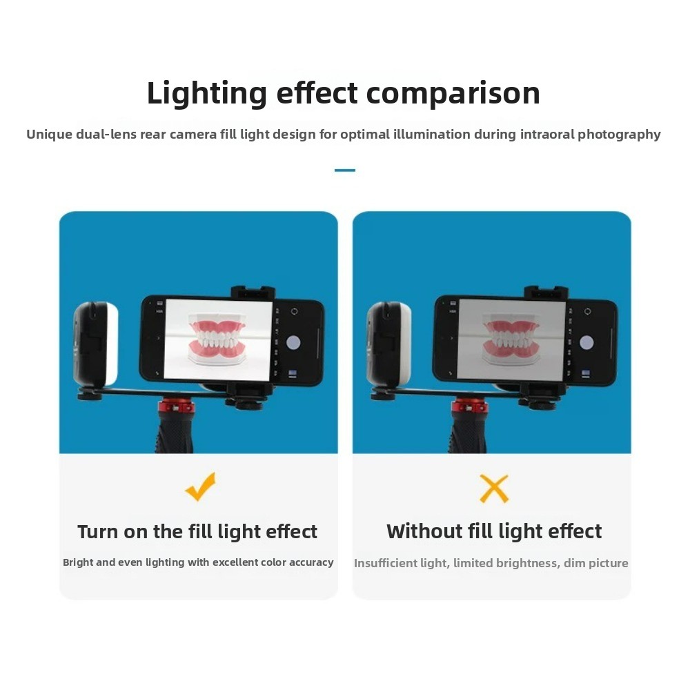Dental Photography Light, Blue - Photography Lighting Kit Portable ulasan dan harga
